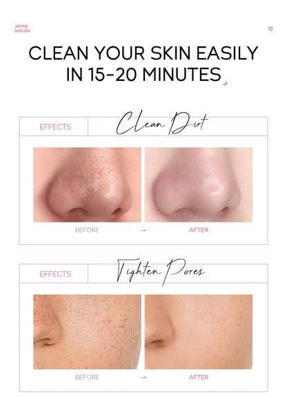 "Mascarilla Facial Peel-Off LAIKOU Oro 24K y Sakura: Antiarrugas, Aclarante y Quita Puntos Negros"